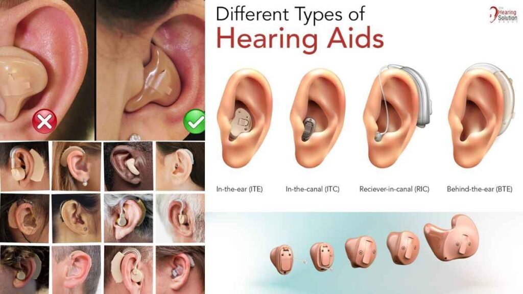 Needs To Know About Hearing Aid Fitting Procedure